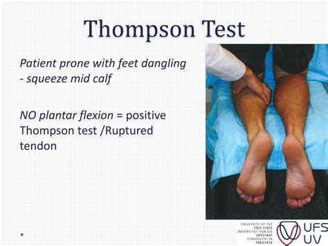 thompson test positive means